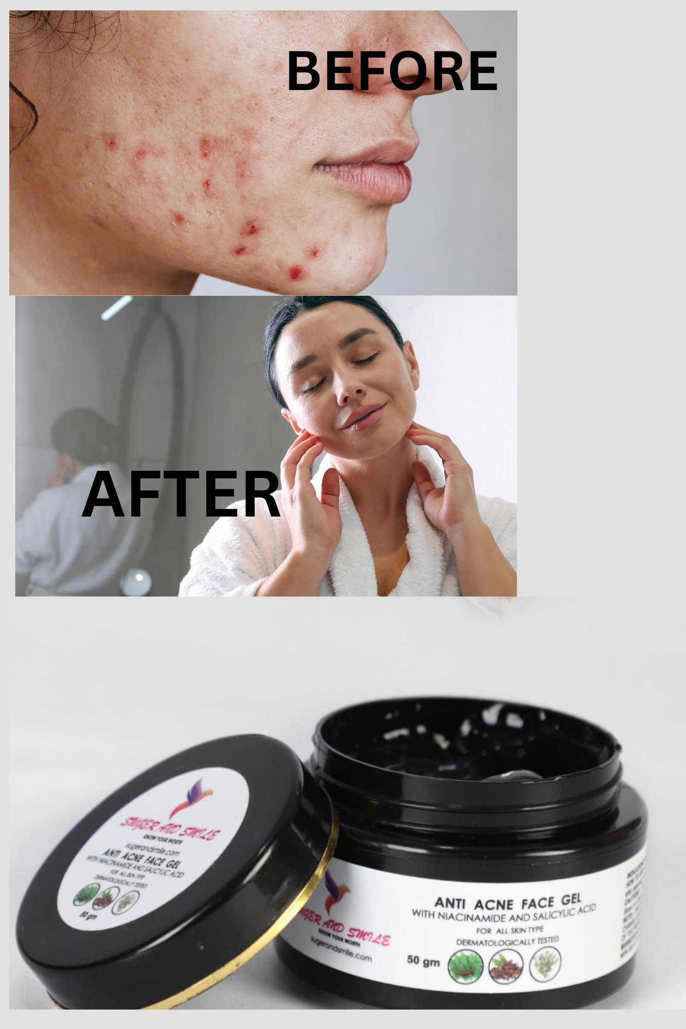 Anti acne face gel(50gm)pack of 2
